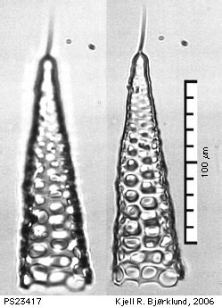  Breviata!  A Microscopic Marvel with Pseudopods That Twist and Turn